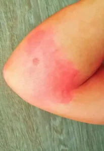 vepsestikk