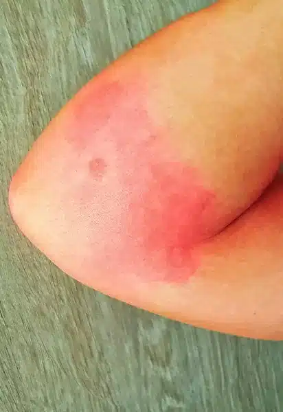 vepsestikk